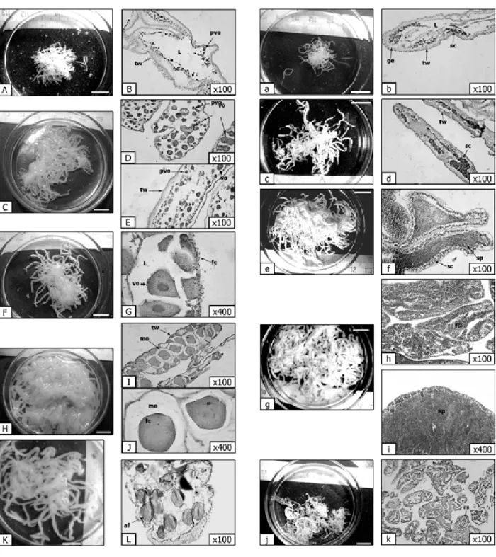 Figure 3.  Macroscopic and microscopic description of female (left) and male (right) gonads characteristics of  Holothuria poli at different maturity stages, scale bar = 10mm