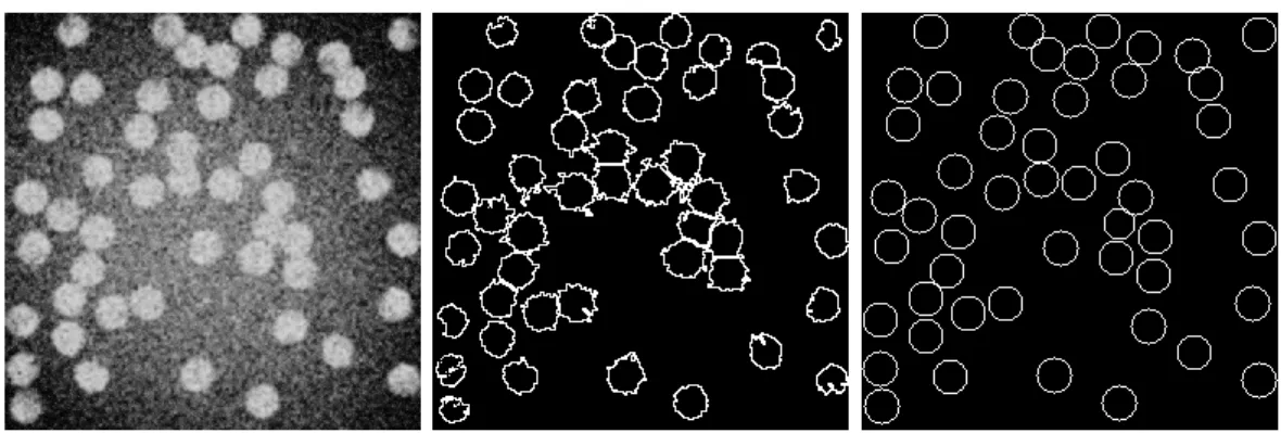 Figure 4: A noisy example of image cells (left) and the detection obtained using the fiji particle analyser (middle) and the MPP approach (right).