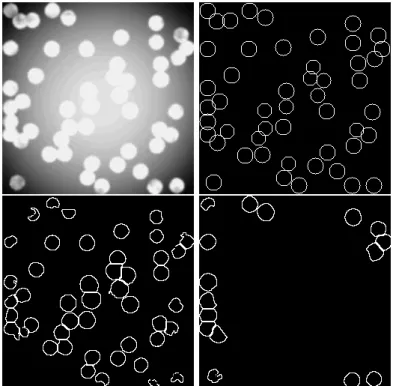 Figure 5: A first exemple of an heterogeneous background (top left), results with the MPP approach (top right) and with two parameter settings for the fiji particle analyser (bottom left and right)
