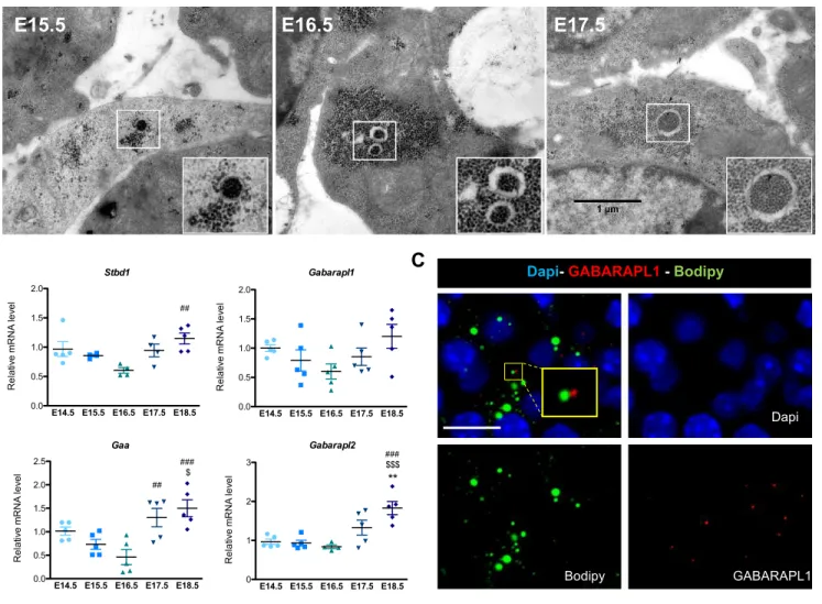 Figure S6. Glycophagy during brown adipocyte differentiation. Related to Figure 4. A, Representative pictures showing glycophagosomes within glycogen granules obtained by TEM on BAT from E15.5 to E17.5 (SB 1µm)