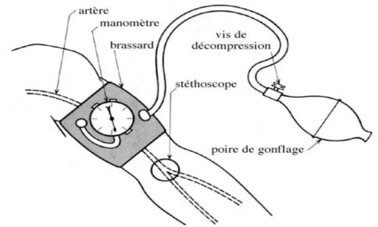 Figure I.10 : Méthode auscultatoire 
