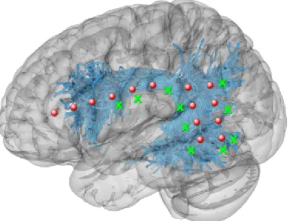 Fig. 1: Tractography-based Arcuate Fasciculus and Superior Longitudinal Fasci- Fasci-culus III (marked as blue streamlines), ECoG electrode placements (red circles), and stimulation points (green crosses).