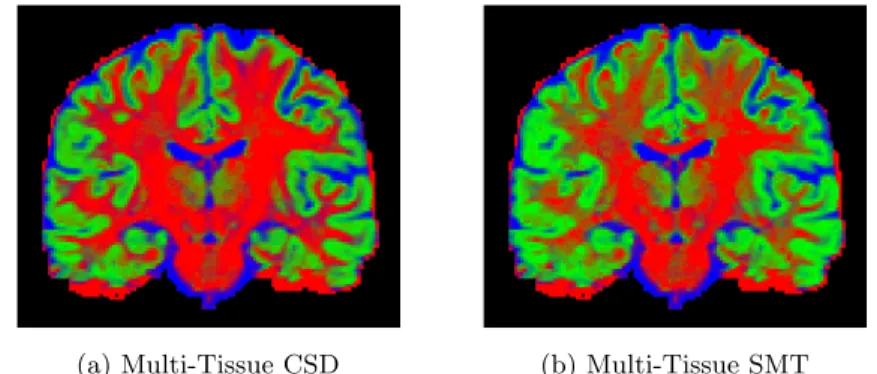 Fig. 5: White Matter, Grey Matter and CSF volume fractions, estimated using (a) MT-CSD and (b) MT-SMT.