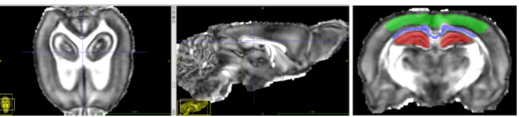 Fig. 1. Regions of interest for biomarker estimation on the registered FA map of rat 1.