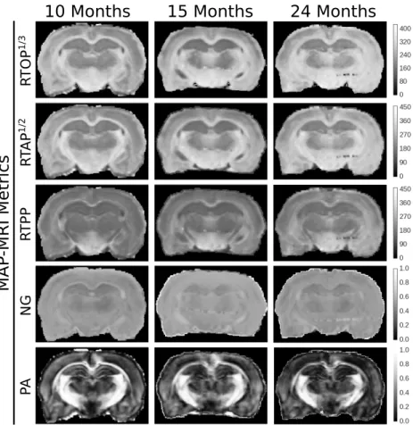 Fig. 3. Illustrations of MAP-MRI’s q-space indices in the same coronal slice for the three time points