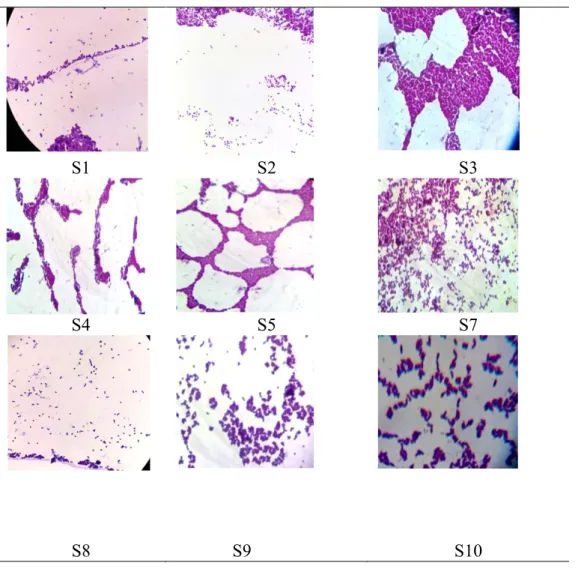 Figure 12 : Coloration de Gram de différentes souches testées 