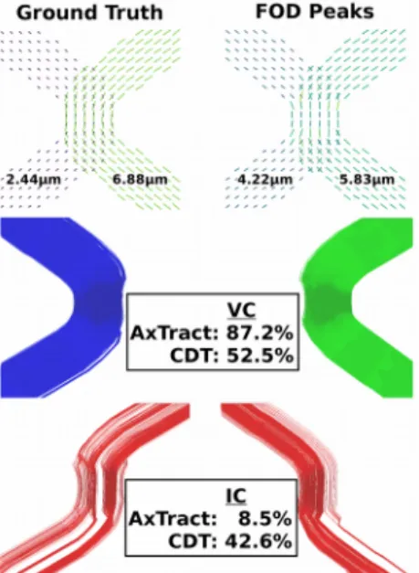 Figure 3: Average occurrence map of AxTract selecting a different propagation direction than CDT over the 34 subjects.