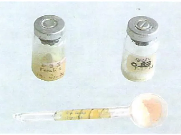 Figure 1 : Les souches lyophilisées utilisées dans cette étude, présentées dans leurs flacons  originaux avant leur récupération