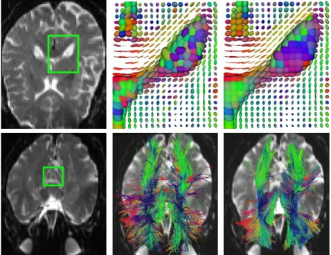 Figure 3.7 Tensor field estimation of a brain (top row) and improvement of the fiber tracking (bottom row)