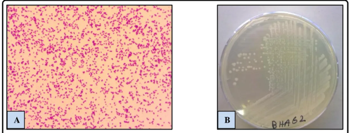 Figure III.2. Examen macroscopique et microscopique (objectif 100X) de l’isolat  BHA62 : Enterobacter aerogenes