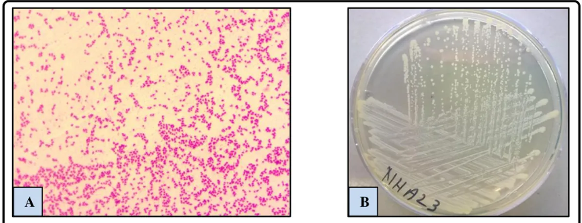 Figure III.5.  Examen macroscopique et microscopique (objectif 100X) de l’isolat  NHA23 :  Serratia odorifera