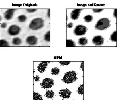 Fig III.2 Résultat de segmentation en niveau de gris de l’image   selon algorithme mpm   
