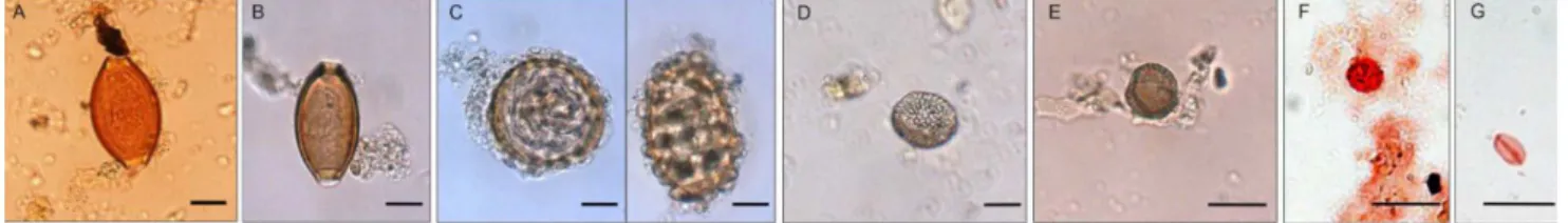 Figure 1. Microscopic observation of unstained and stained Namur coprolite (optical magnification: 1006 )