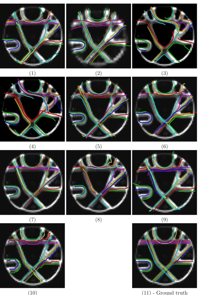 Figure 6: Each of the 10 contributions is shown individually. Image (11) repre- repre-sents the ground truth for visual comparison