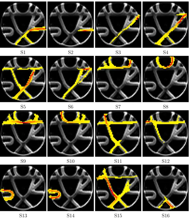 Figure 8: Probabilistic tractography of the phantom dataset using FSL. The connectivity maps are shown on top of the b 0 image