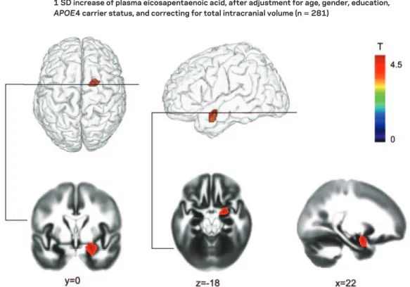 Figure 1 Specific area of lower gray matter atrophy over 4 years within the medial temporal lobe with each 1 SD increase of plasma eicosapentaenoic acid, after adjustment for age, gender, education, APOE4 carrier status, and correcting for total intracrani