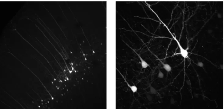 Fig. 1. Maximum intensity projections of the two different types of images dealt with: the 10x images showing the whole cortex (left), and a 40x image focusing on the somas (right).
