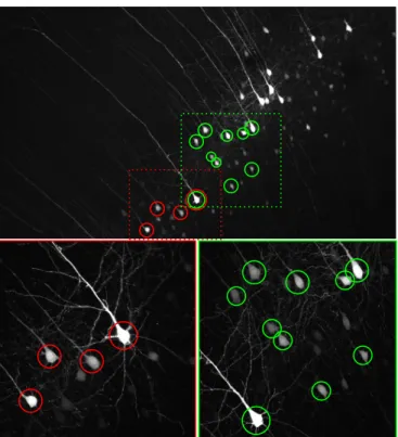 Fig. 4. Example of the resultant correspondence map. The corresponding neurons are circled with the same colors on a 10x image (top, cropped) and two of the corresponding 40x images (bottom)