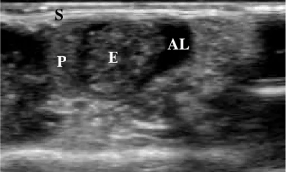 Figure 4: Transabdominal image of the embryo with a 7-15MHz linear probe. E : Embryo, AL : Amniotic Liquid,  P  :  Placenta,  S  :  Mouse  skin  (and  image artefacts).