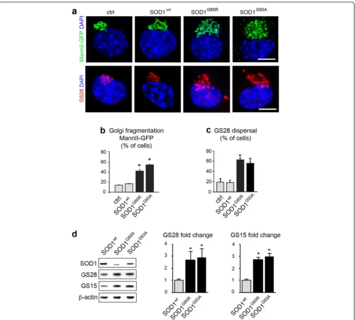 Fig. 2 Golgi alterations in mutant SOD1-transfected NSC-34 motor neurons. a. Confocal images (upper panels) showing Golgi fragmentation with the marker MannII-GFP in NSC-34 cells transfected for 4 DIV with mutant SOD1, as compared to the situation in contr