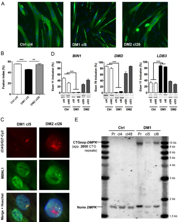 Fig. 2. Characterization of DM myoblast cell lines. (A) Representative cultures of Ctrl (cl4), DM1 (cl5) and DM2 (cl26) immortalized myoblasts differentiated for 4 days and then fixed for immunofluorescence analysis using desmin antibody (green) and Hoechs