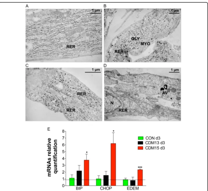 Fig. 4 Analysis of the rough endoplasmic reticulum (RER). Representative micrographs of normal RER observed with transmission electron microscopy at day 3 in CON (a, b) and CDM13 (c), and of very enlarged RER present in CDM15 myoblasts (d)