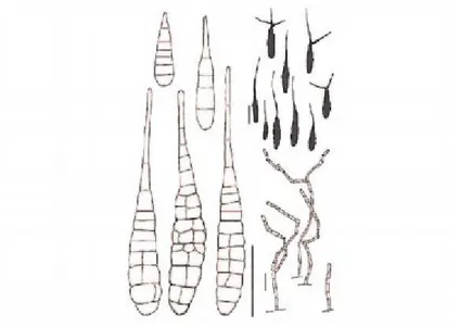 Figure 06 : conidies et conidiophores de A.solani (Simmons, 2007) 