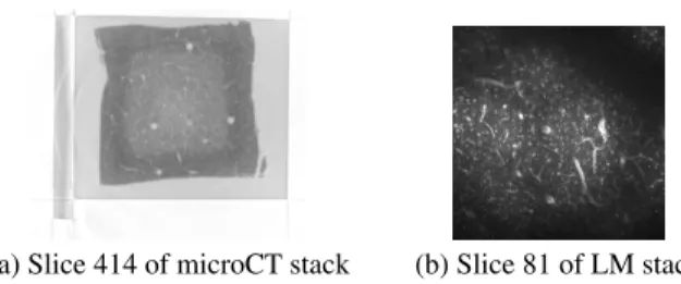 Fig. 1. Exp. 1: 3D CLEM