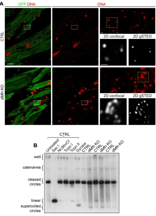 Fig 4. Loss of outer membrane fusion does not affect mtDNA topology. (A) Representative deconvoluted confocal and STED images of mtDNA from heart sections of control and dMfn KO animals at 4 weeks of age
