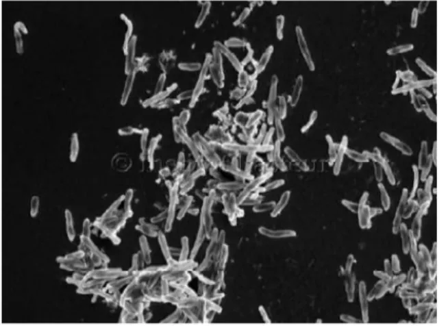 Figure 1 : Mycobactéries du complexe M. tuberculosis en microscopie électronique à balayage [7]