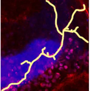 Fig. 4. Zoom of the Z projected image showed in Figure 3, where the neuron has been segmented  to obtain a tree-like set of numeric 3D curves