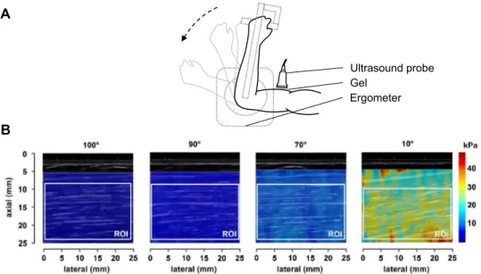 Fig. 1. (a) Lateral view of the experimental setup. (b) Typical recordings of shear modulus measurements using shear wave elastography in the short head of the biceps brachii at 100°, 90°, 70° and 10° elbow joint angles in one patient with inclusion
