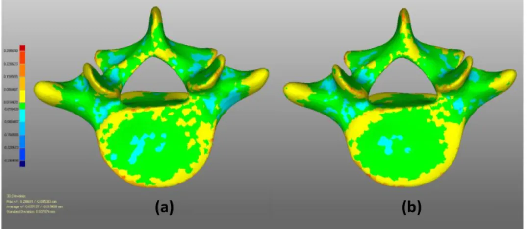 Figure 3.6: The magnitude of 3D deviation of vertebra performed with Geomagic  relaxing (a) Prime model (b) Smoothed model (1 iteration)