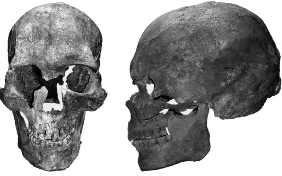 Figure 8 - Vue antérieure et latérale du bloc crânio-facial et de la mandibule de l’individu de la sépulture 2
