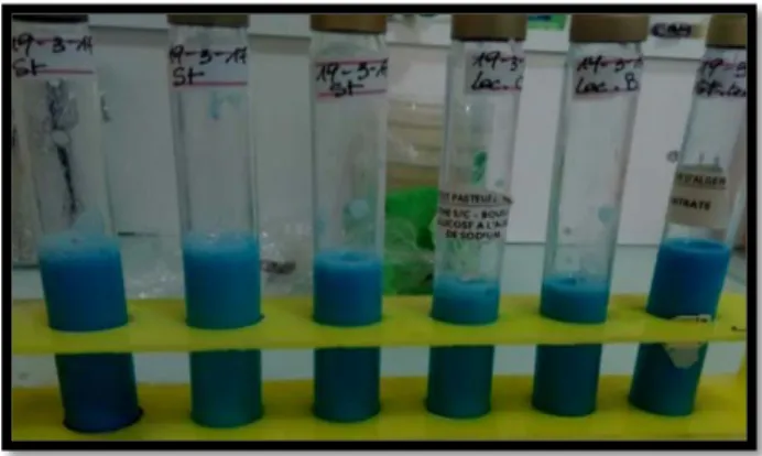 Figure 04 : culture sur lait de sherman La souche a été ensemencée dans le lait écrémé au  bleu de méthylène 