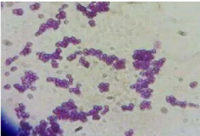 Figure 14 : Observation Microscopique d’une Streptococcus : des Coques (G×100). 
