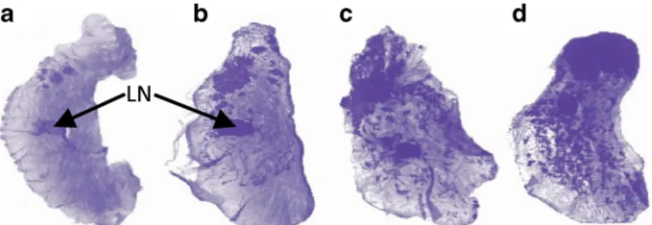 Fig. 1 Spontaneous multifocal tumoral progression. Hematoxylin-stained whole mount sample of mammary glands from untreated PyMT mice at a W4, b W7, c W9, and d W10