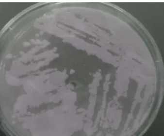 Figure 03: Macroscopic aspect of E. coli bacteria development on TGEA agar. 