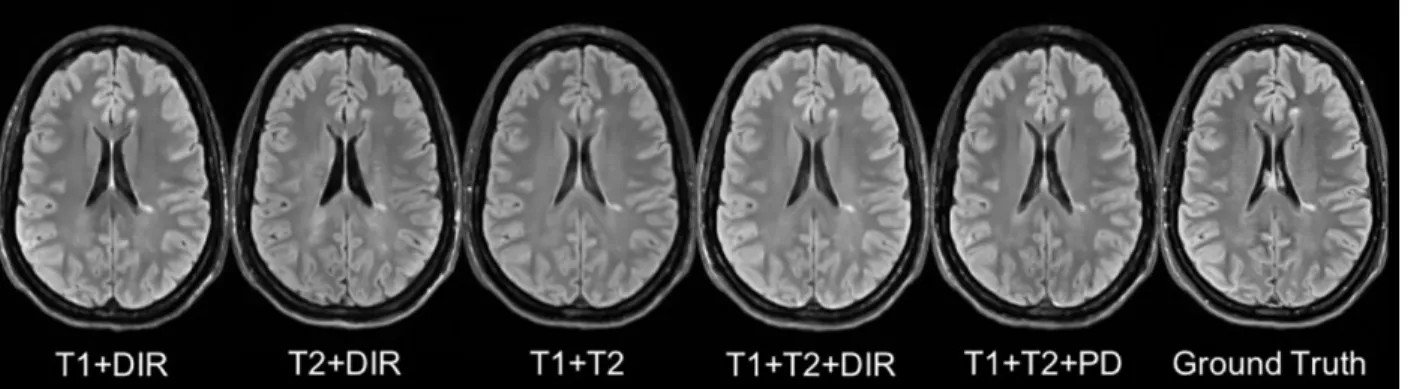 Fig 7: Different Combinations of T1, T2, DIR and PD as input sequences.