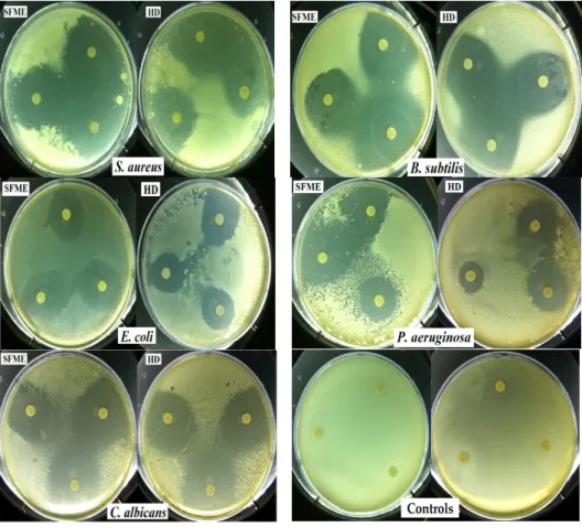 Table 4. Result of antimicrobial activity of sweet basil EO obtained by SFME and HD. 