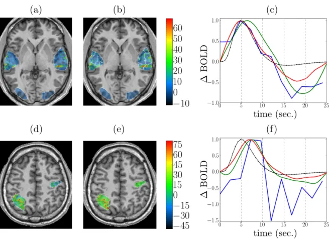 Figure 7. Detection and estimation results on the shipped real data set. Top and bottom rows: auditory and computation experimental conditions, respectively.