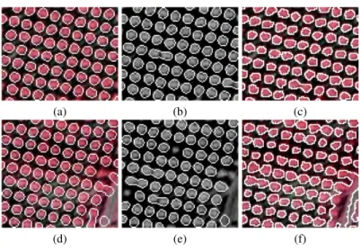 Fig. 6. Top row: results obtained on the image shown in figure 2(a), using the new model (a), the single band model of [2] (b), and the classical active contour model combined with the  multi-spectral data term (c)