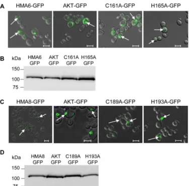 FIGURE 5.Functional expression of HMA6-GFP and HMA8-GFP mutants in yeast. A and B, the intracellular localization in yeast of HMA6 and HMA6 mutants fused to GFP (AKT-GFP, C161A-GFP, and H165A-GFP) was  deter-mined by confocal fluorescence microscopy