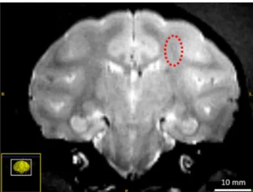 Figure 4.  T2-weighted images one month after BBB opening shows a suspicious contrast in the focal region  (dashed circle)
