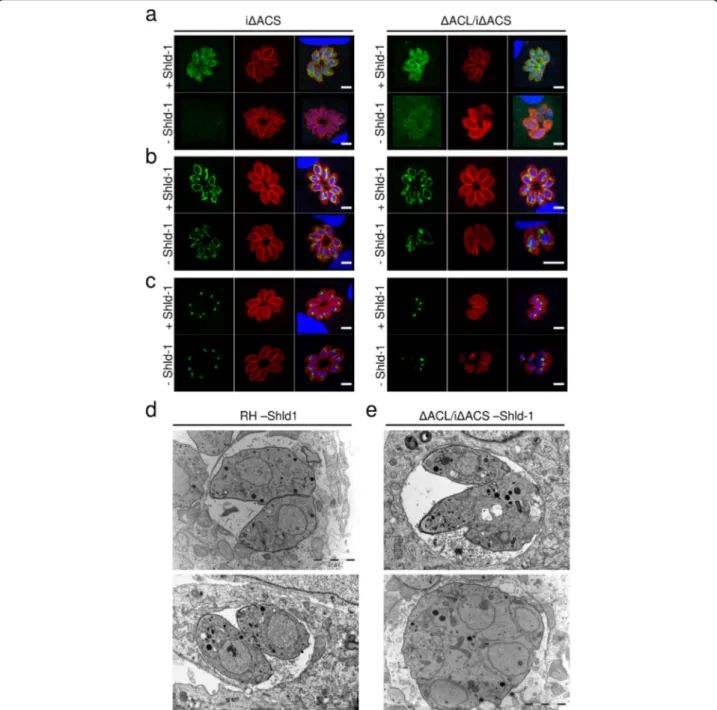 Fig. 2 Loss of ACS and ACL is associated with amorphic cells and loss of organelle integrity