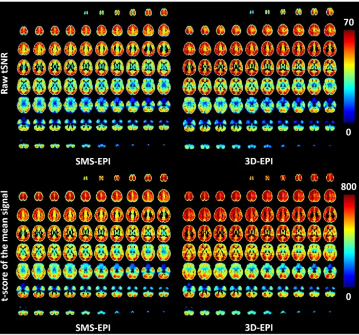 Fig 4. tSNR maps. Raw tSNR (upper row) and t-score testing with FAST for the mean signal (lower row) measured on average over the population for the SMS-EPI and 3D-EPI sequences.