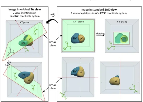 Fig. 1: Schematic representation of multiplanar reformatting to SAX view. On the left, original TA view in m coordinate system