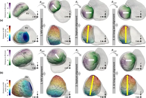 Fig. 2: Two examples of rotation to SAX view using surface meshes. The LV endocardial surface is colored according to its distance to the RV (1st and 3rd row) and according to its distance to the centre of the MV (2nd and 4th row)