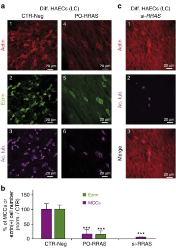 Figure 6 | The direct repression of RRAS by miR-449 affects
