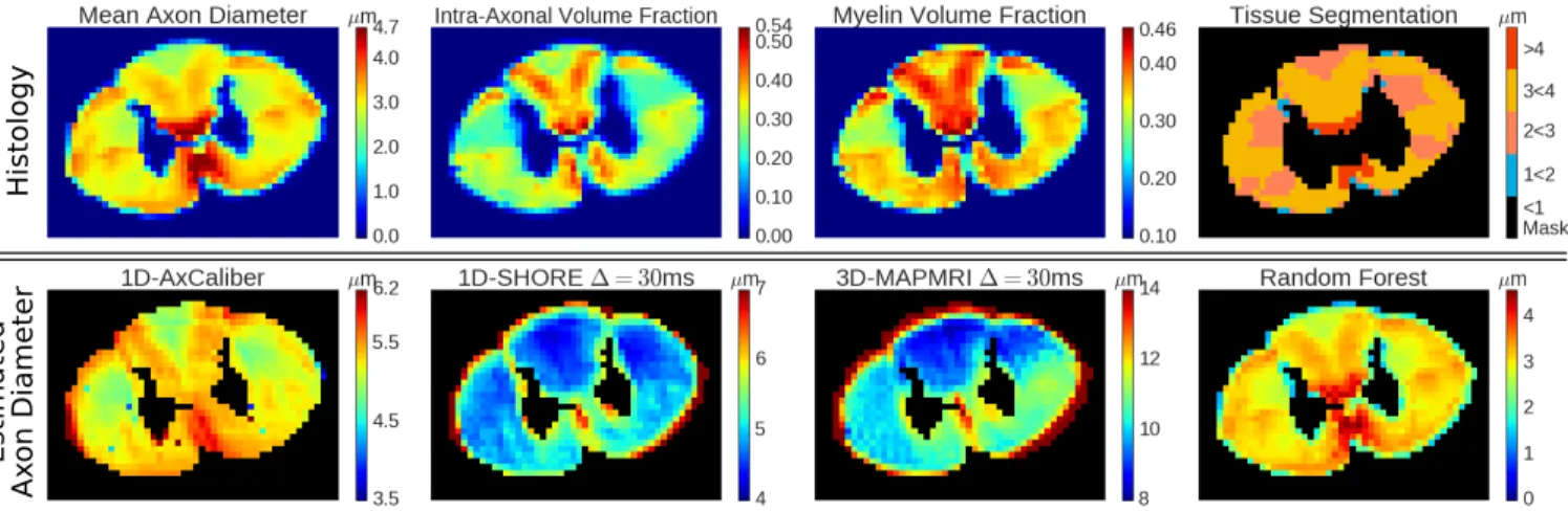 Fig. 1. Top row, from left to right: Histology values of mean axon diameter, intra-axonal volume fraction, and myelination.